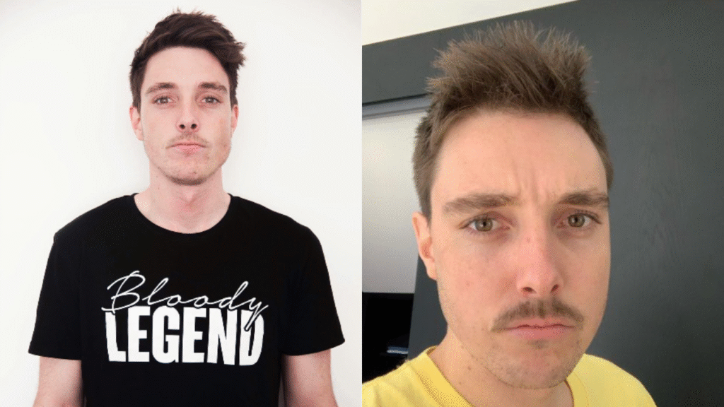 LazarBeam Biography and Unknown Facts